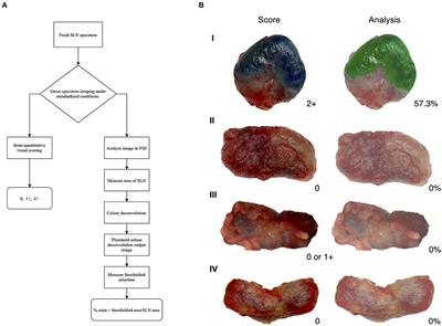 Quantitative and Semi-quantitative Methods for Assessing the Degree of Methylene Blue Staining in Sentinel Lymph Nodes in Dogs